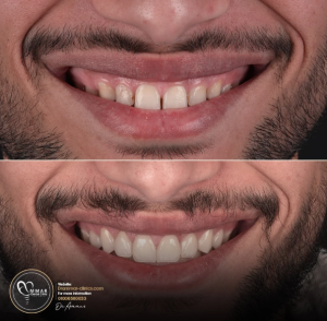 مركز دكتور عمار لطب الاسنان