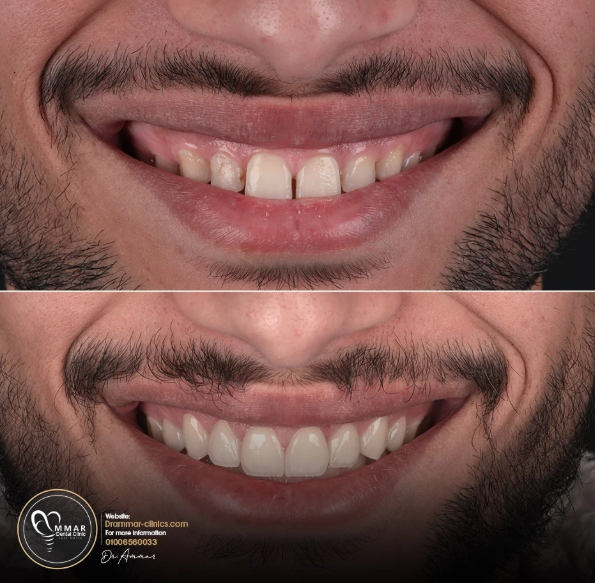 مركز دكتور عمار لطب الاسنان